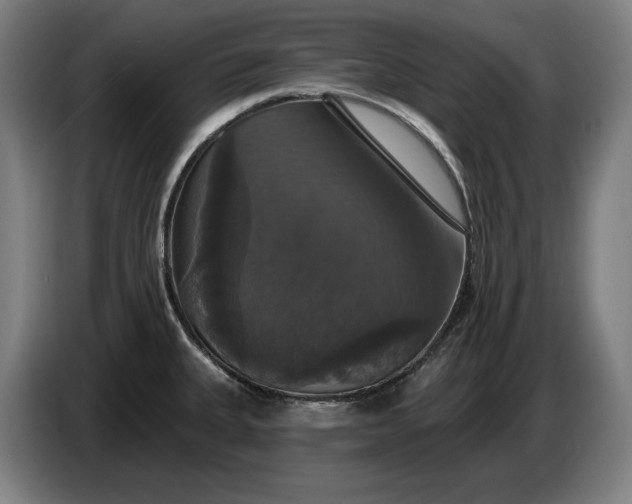 X0000087411335200705041240