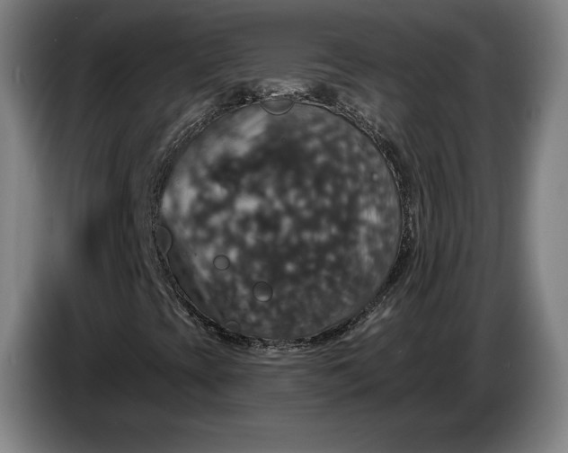 X0000087411393200705041238