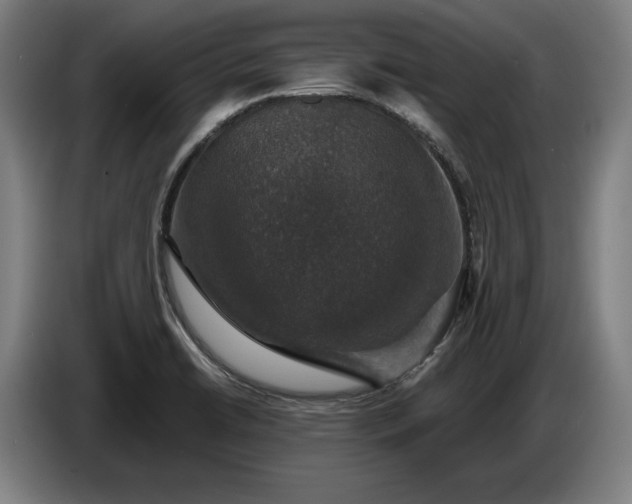 X0000087411422200705041239