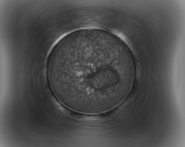 X0000087411460200705041238