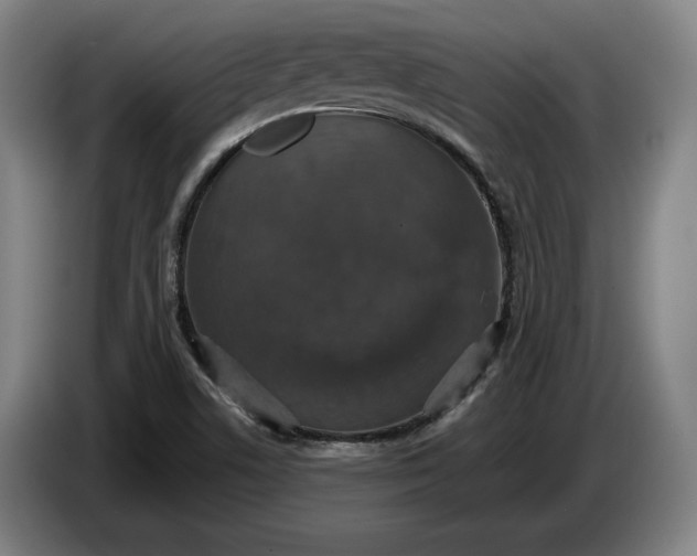 X0000087411506200705041237