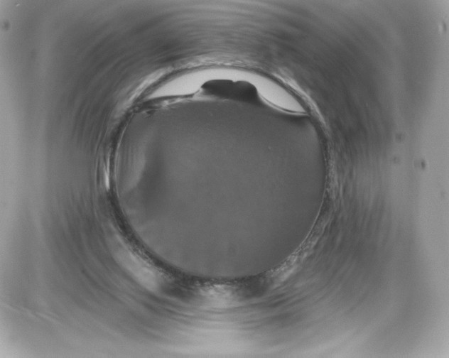 X0000087410062200705111901