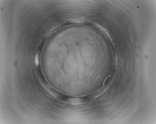 X0000087410069200705111902