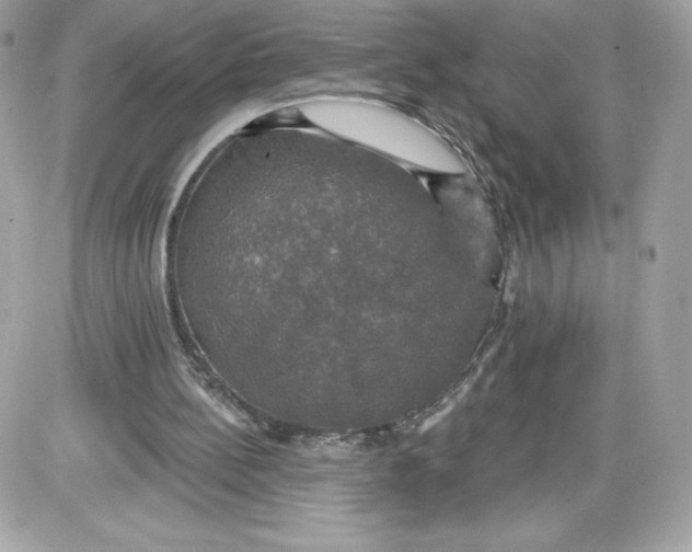 X0000087410148200705111900