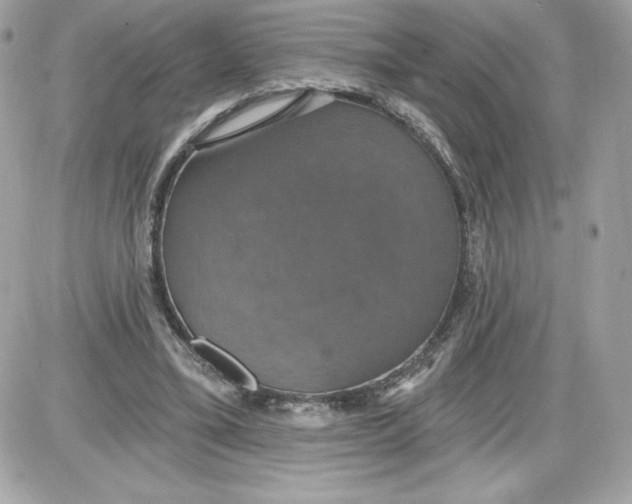 X0000087410395200705111856