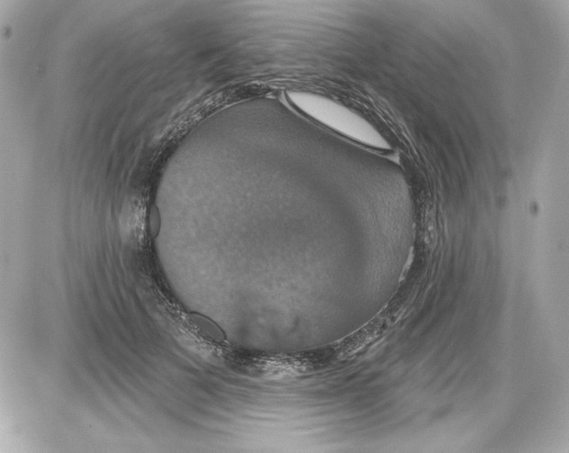 X0000087410697200705111851