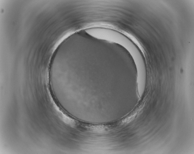 X0000087410999200705111847