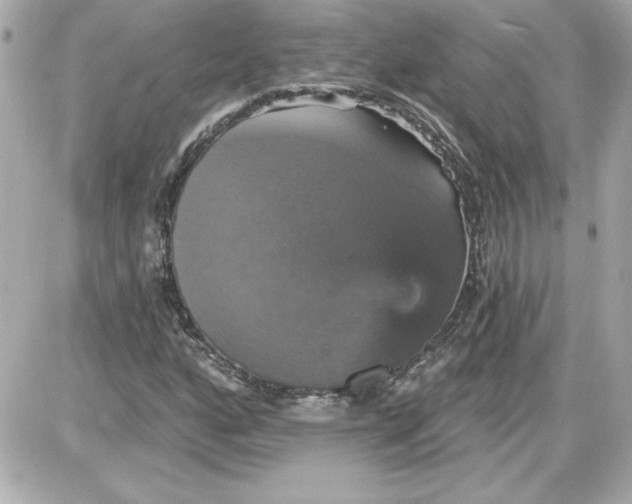 X0000087411160200705111844