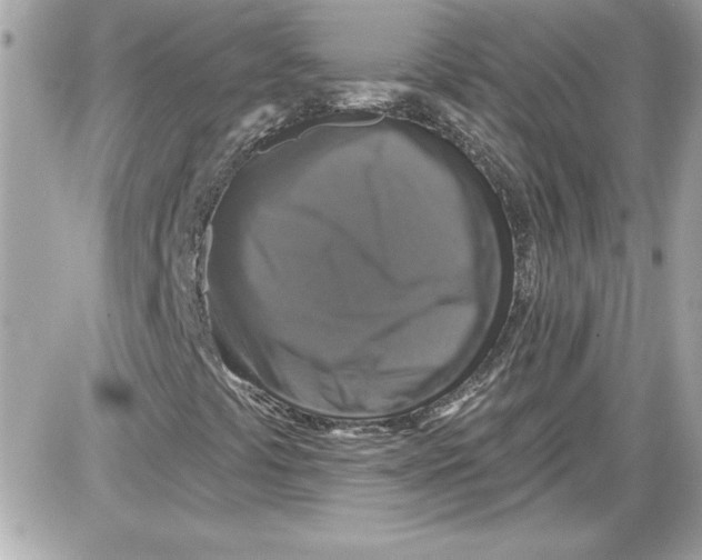 X0000087411441200705111839