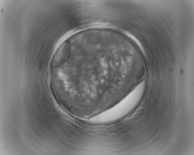 X0000087411467200705111839