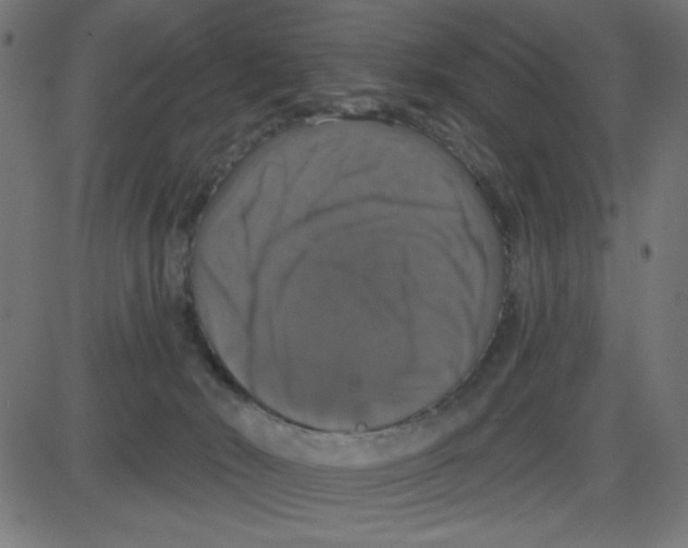 X0000087410030200705181409