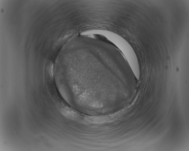 X0000087410041200705181408