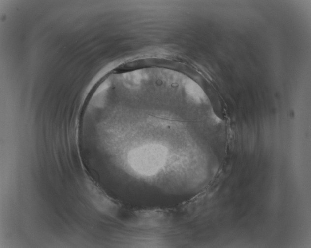 X0000087410100200705181407