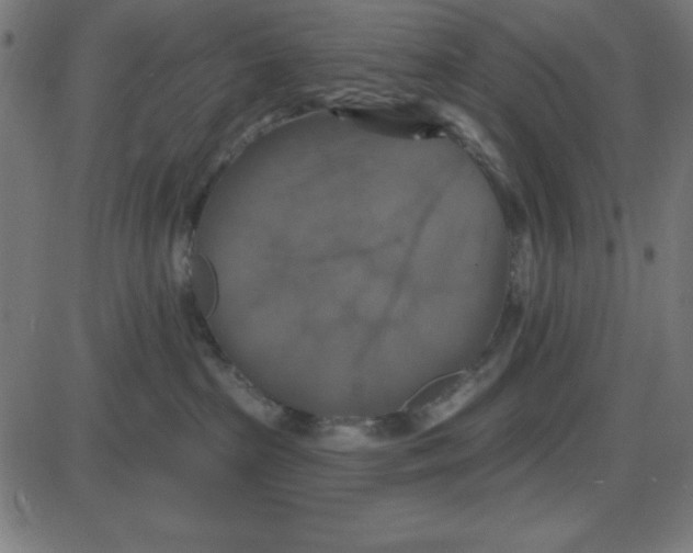 X0000087410285200705181405