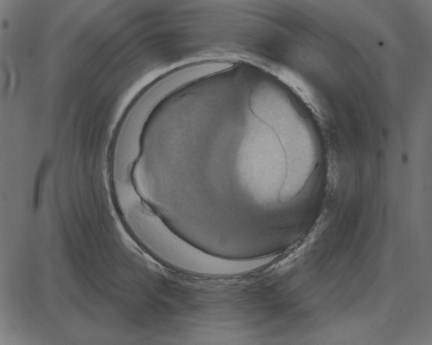 X0000087410950200705181354