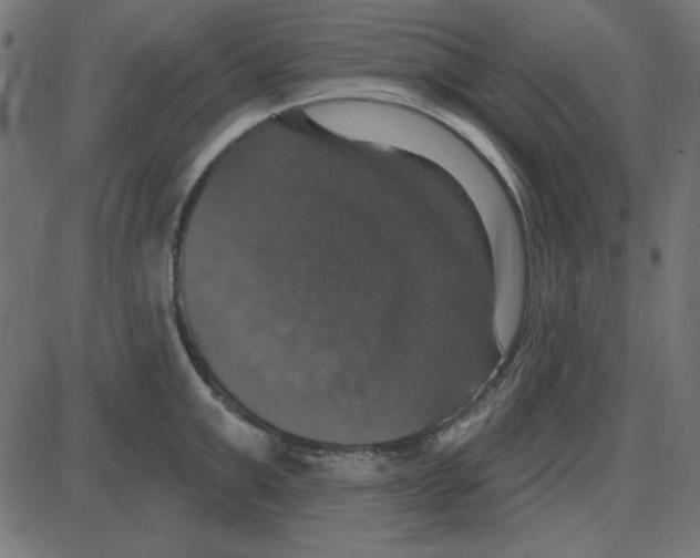 X0000087410999200705181353