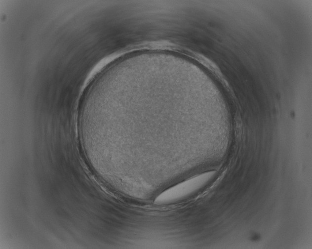 X0000087411176200705181350