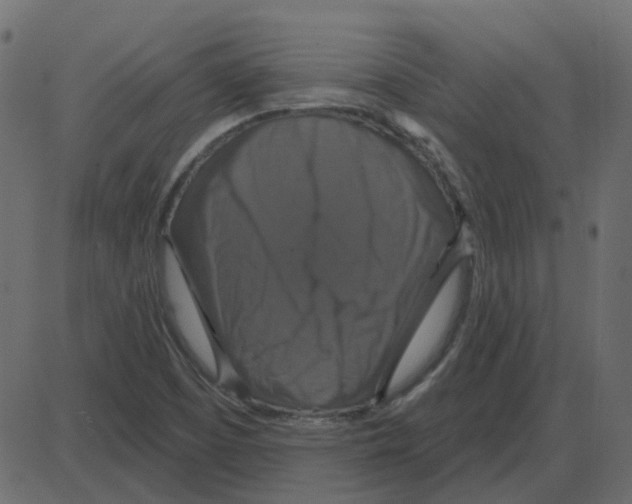 X0000087411457200705181345