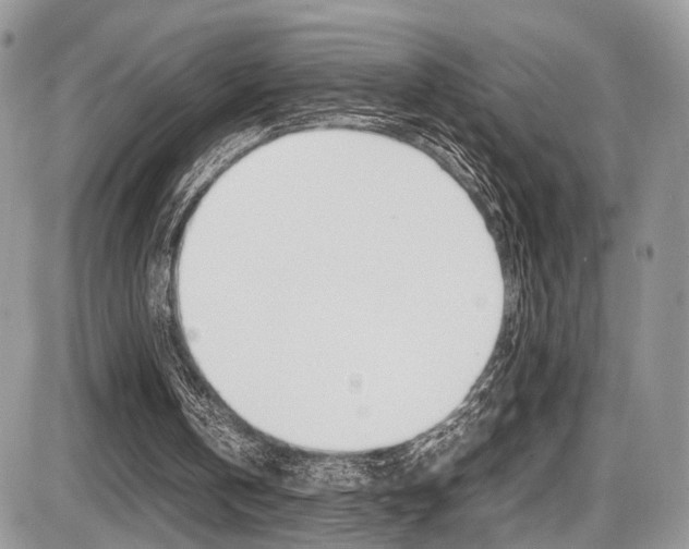 X0000087420146200704201054