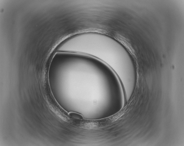 X0000087420156200704201054