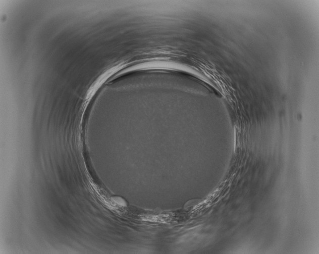 X0000087420147200704201434