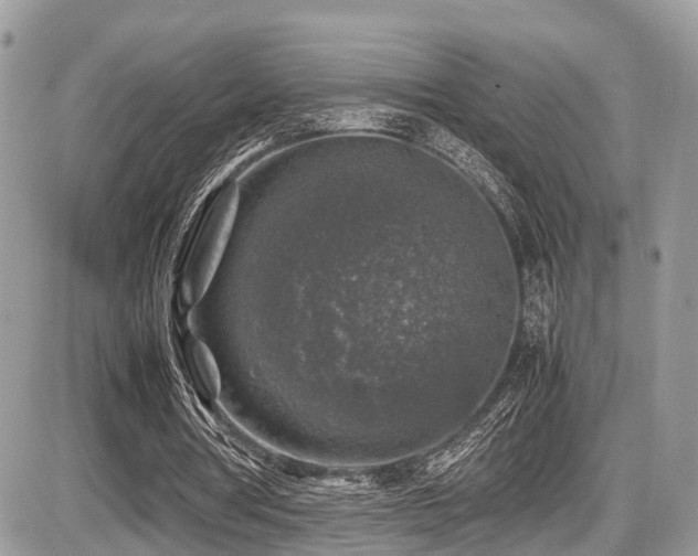 X0000087420386200704201431