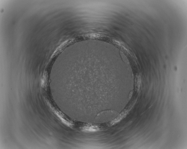 X0000087420760200704201425