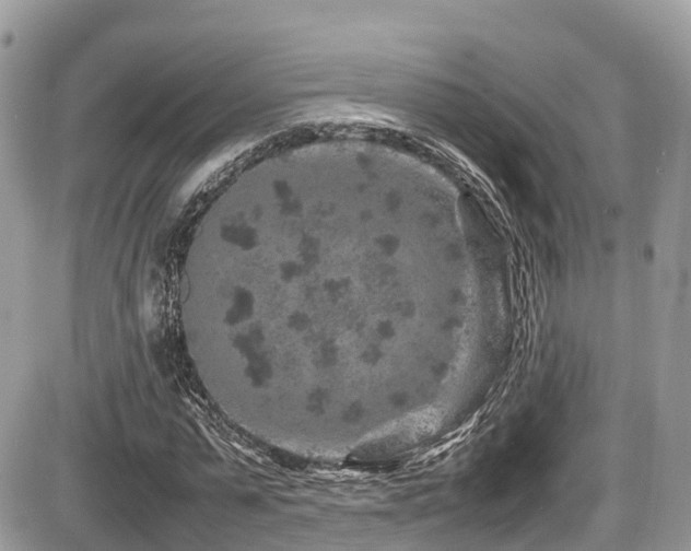 X0000087420775200704201425