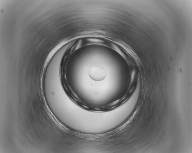 X0000087421196200704201418