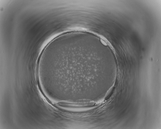 X0000087421295200704201416