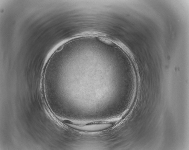 X0000087421296200704201416