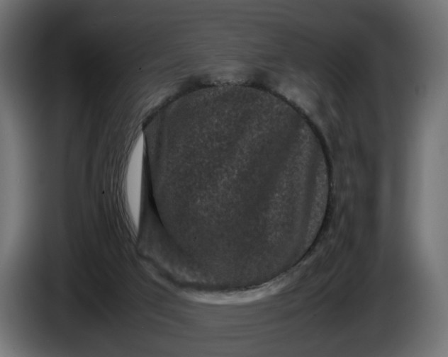X0000087420017200705041317