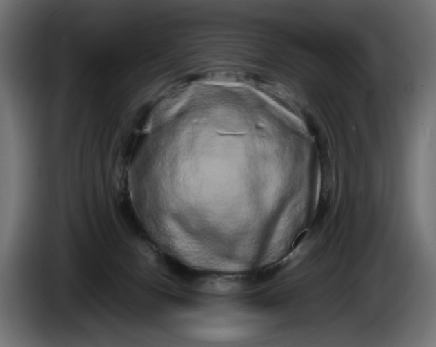 X0000087420078200705041316