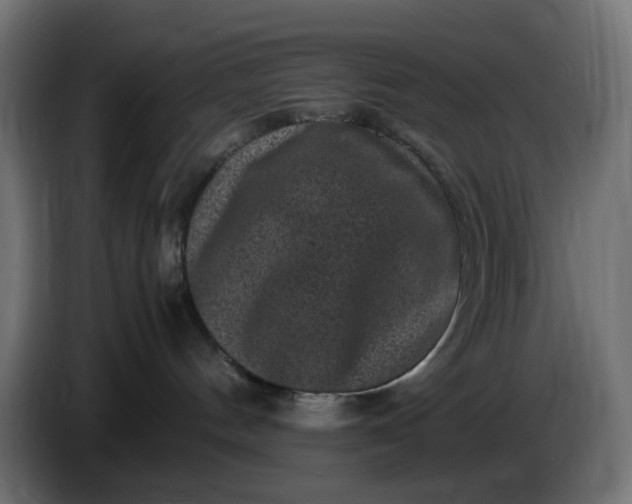 X0000087420144200705041315