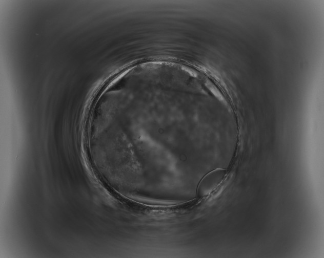 X0000087420145200705041314