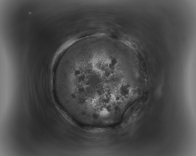 X0000087420149200705041314