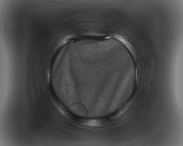 X0000087420157200705041315