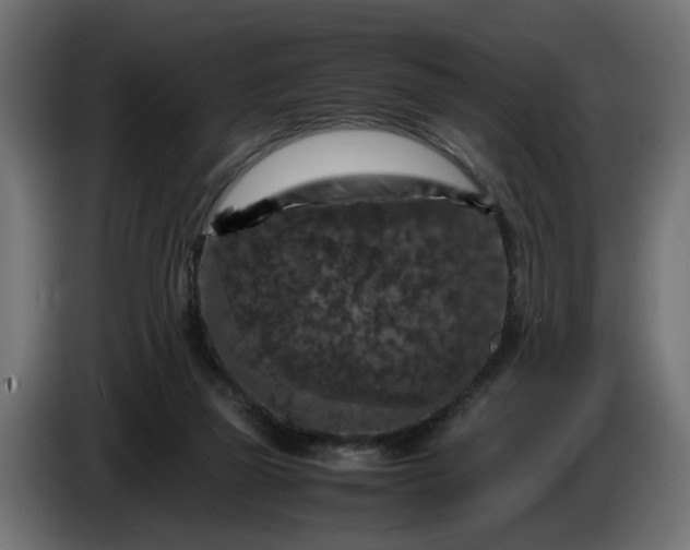 X0000087420165200705041315