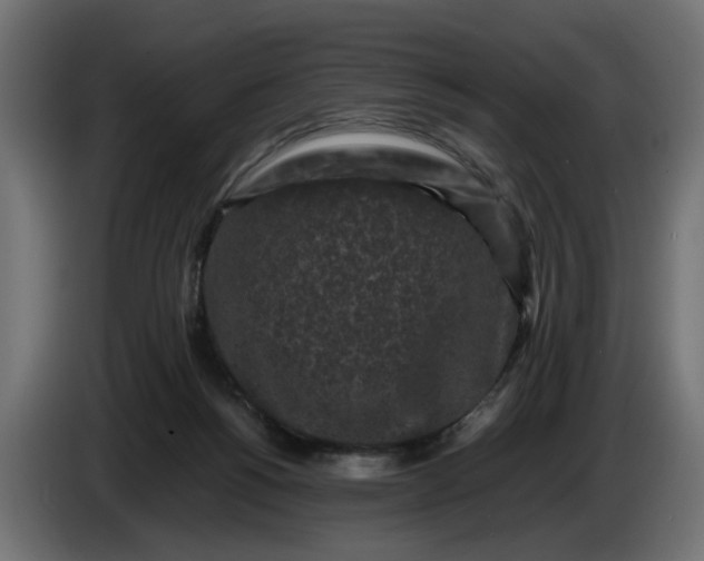 X0000087420168200705041315