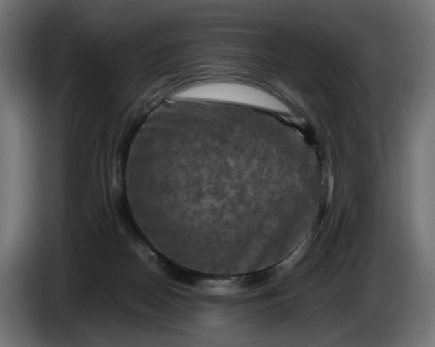 X0000087420170200705041315
