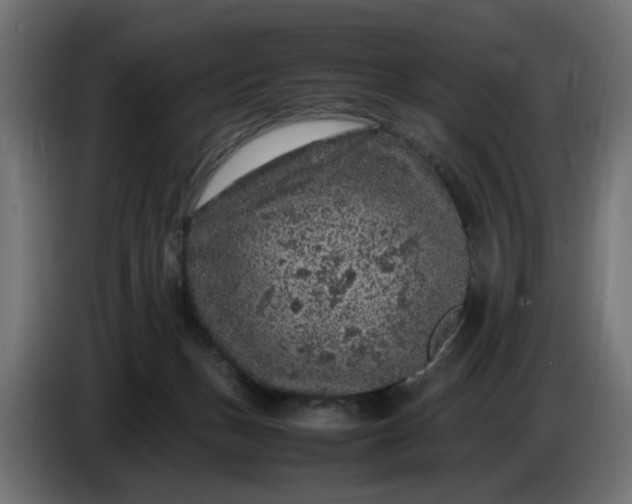 X0000087420175200705041315
