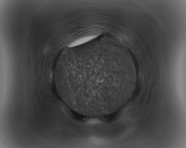 X0000087420177200705041315