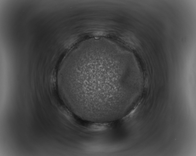X0000087420179200705041315