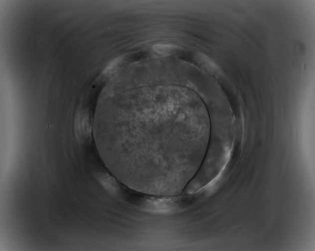 X0000087420186200705041315