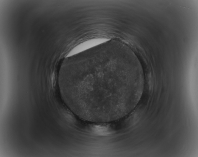 X0000087420232200705041314