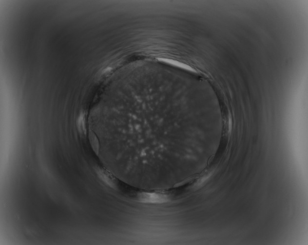 X0000087420286200705041314