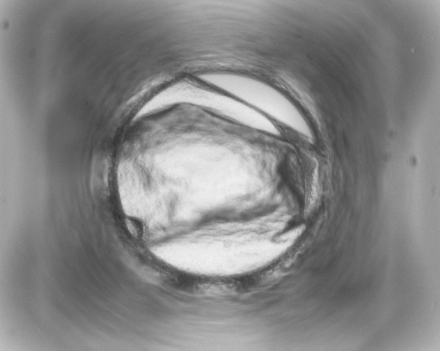X0000087420115200705111926