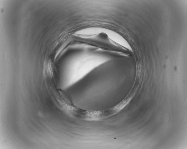 X0000087420143200705111925