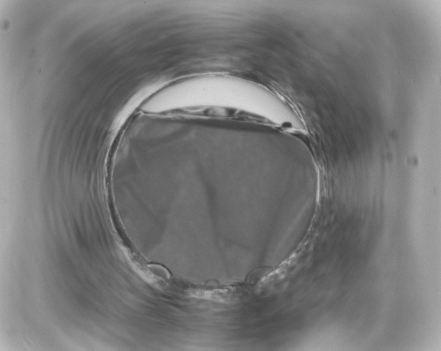 X0000087420147200705111925