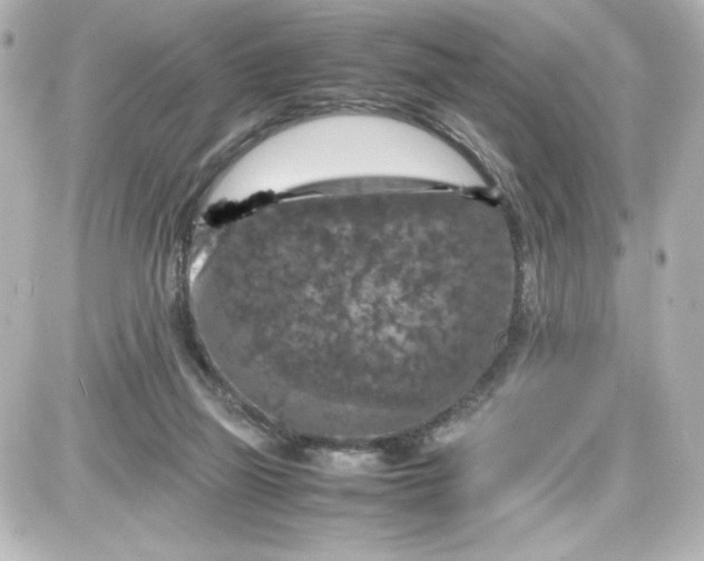 X0000087420165200705111925